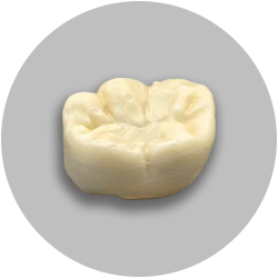  标准比色陶瓷渐变牙冠